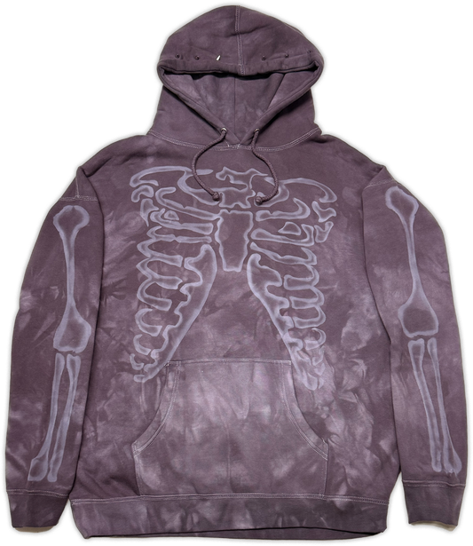 A purple tie-dye hoodie featuring a large white skeletal rib cage graphic on the front and white bone graphics printed down both sleeves.